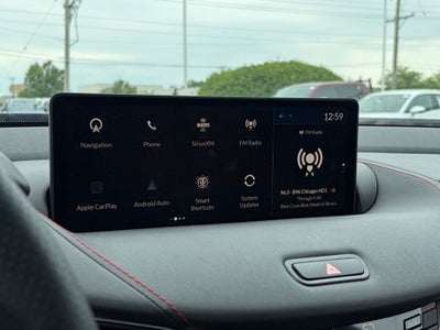 2025 Acura TLX A-Spec Package SH-AWD